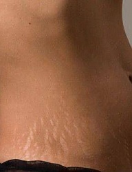 Misz-masz - 2654693