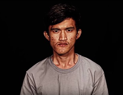 Tak wyglądał 22-letni Tajlandczyk przed operacją